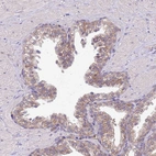 Immunohistochemical staining of human prostate shows weak membranous positivity in glandular cells.