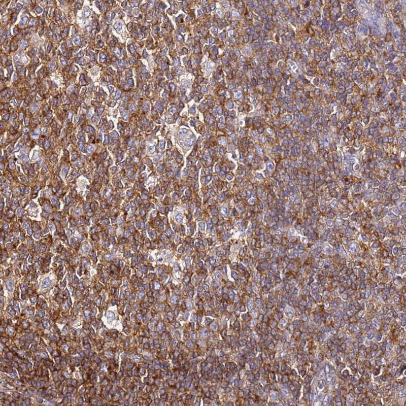 Anti-ZNF671 Antibody