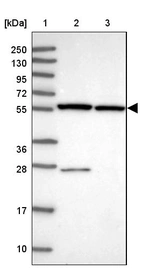 Lane 1: Marker [kDa] 250, 130, 95, 72, 55, 36, 28, 17, 10_br/_Lane 2: Human cell line RT-4_br/_Lane 3: Human cell line U-251MG sp