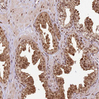 Anti-PEX14 Antibody