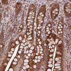 Immunohistochemical staining of human gastrointestinal shows strong cytoplasmic positivity in glandular cells.