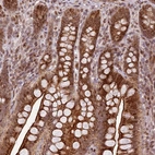 Immunohistochemical staining of human gastrointestinal shows strong cytoplasmic positivity in glandular cells.