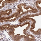 Immunohistochemical staining of human fallopian tube shows strong cytoplasmic positivity in glandular cells.