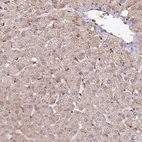 Immunohistochemical staining of human liver shows moderate cytoplasmic granular positivity in hepatocytes.