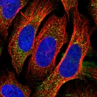 Immunofluorescent staining of human cell line U-2 OS shows localization to peroxisomes.