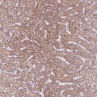 Anti-RNF181 Antibody