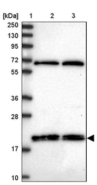 Lane 1: Marker [kDa] 250, 130, 95, 72, 55, 36, 28, 17, 10_br/_Lane 2: Human cell line RT-4_br/_Lane 3: Human cell line U-251MG sp