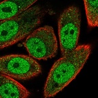 Immunofluorescent staining of human cell line PC-3 shows localization to nucleoplasm & cytosol.