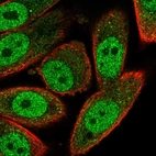 Immunofluorescent staining of human cell line PC-3 shows localization to nucleoplasm & cytosol.