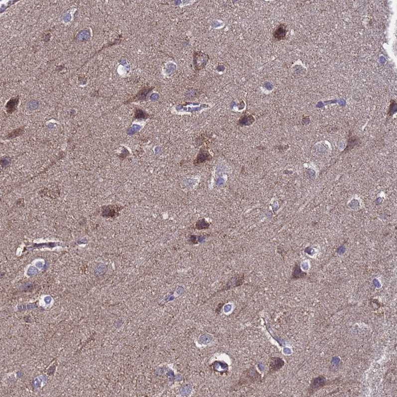 Anti-ANAPC13 Antibody