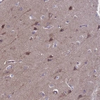 Anti-ANAPC13 Antibody