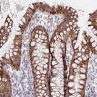 Anti-C6orf223 Antibody