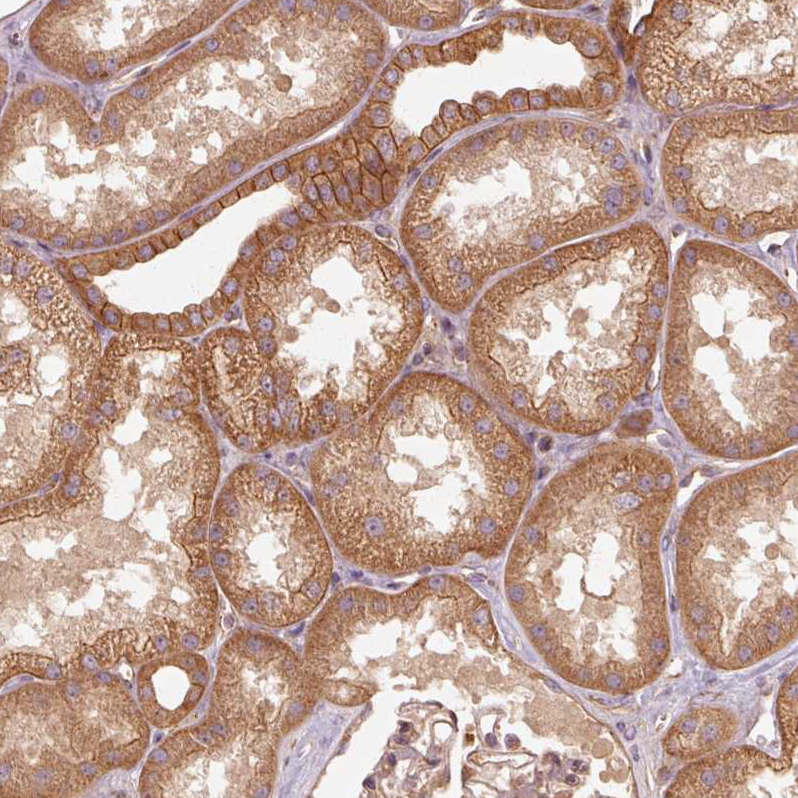 Anti-CTNNA1 Antibody