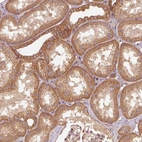 Anti-CTNNA1 Antibody