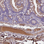 Immunohistochemical staining of human small intestine shows strong positivity in secretion.