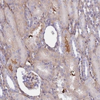 Immunohistochemical staining of human kidney shows moderate to strong positivity in secretion.