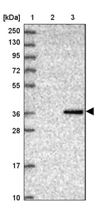 Lane 1: Marker [kDa] 250, 130, 95, 72, 55, 36, 28, 17, 10_br/_Lane 2: Human cell line RT-4_br/_Lane 3: Human cell line U-251MG sp