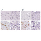 Anti-POMC Antibody