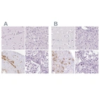 Anti-POMC Antibody
