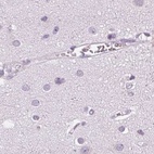 Immunohistochemical staining of human cerebral cortex using Anti-POMC antibody HPA046135.