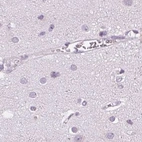 Immunohistochemical staining of human cerebral cortex using Anti-POMC antibody HPA046135.