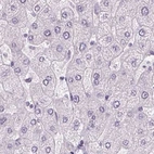 Immunohistochemical staining of human liver using Anti-POMC antibody HPA046135.