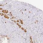 Immunohistochemical staining of human pituitary gland using Anti-POMC antibody HPA046135.