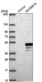 Western blot analysis in control (vector only transfected HEK293T lysate) and MAGEB18 over-expression lysate (Co-expressed with a C-terminal myc-DDK tag (~3.1 kDa) in mammalian HEK293T cells, LY406567).