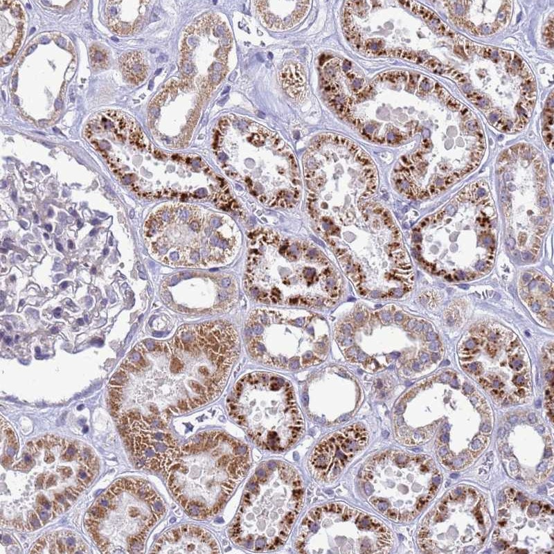 Anti-C12orf43 Antibody