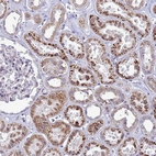 Anti-C12orf43 Antibody