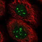 Immunofluorescent staining of human cell line A-431 shows localization to nucleoli.