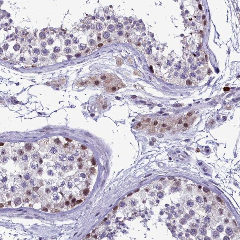 Anti-POM121L2 Antibody