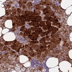 Anti-RSPO1 Antibody