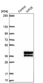 Anti-KIF25 Antibody