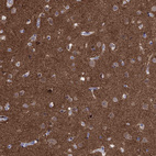 Anti-AMN1 Antibody