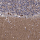 Immunohistochemical staining of human cerebellum shows moderate cytoplasmic positivity in cells in molecular layer.