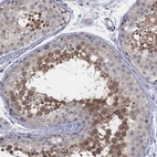 Immunohistochemical staining of human testis shows moderate cytoplasmic positivity in cells in seminiferous ducts.