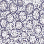 Immunohistochemical staining of human rectum shows no positivity in glandular cells as expected.