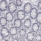 Immunohistochemical staining of human rectum shows no positivity in glandular cells as expected.