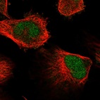 Immunofluorescent staining of human cell line U-251 MG shows localization to nucleus.