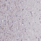 Immunohistochemical staining of human cerebral cortex shows high expression.