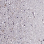 Immunohistochemical staining of human cerebral cortex shows high expression.