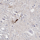 Immunohistochemical staining of human hypothalamus shows strong positivity in subsets of neuronal projections.