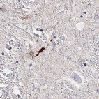 Anti-LUZP2 Antibody