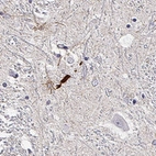 Immunohistochemical staining of human hypothalamus shows strong positivity in subsets of neuronal projections.