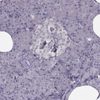 Immunohistochemical staining of human pancreas shows low expression as expected.
