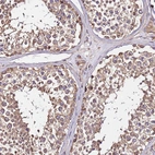 Anti-LRRIQ1 Antibody