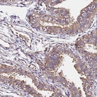 Immunohistochemical staining of human fallopian tube shows moderate cytoplasmic positivity in glandular cells.