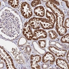 Immunohistochemical staining of human kidney shows strong cytoplasmic positivity in cells in tubules.