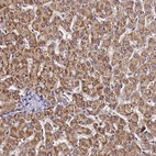 Immunohistochemical staining of human liver shows moderate positivity in hepatocytes.